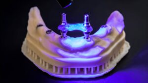 Flujo digital para prótesis híbrida superior e inferior